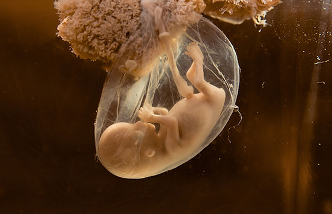 Schwangere zur Abtreibung gezwungen