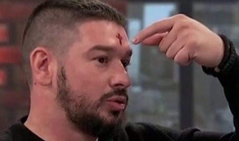 Blutendes Kreuz: Serbe behauptet, das Wundmal Christi zu tragen? (FOTOS)