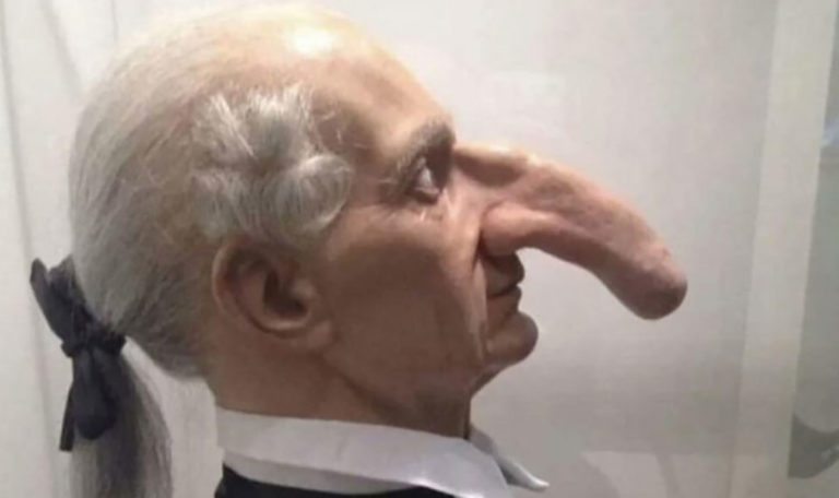 Mann hatte längste Nase der Welt: 19cm! (FOTO)
