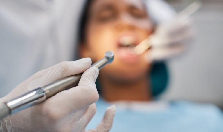 Zahnprobleme lähmen halbes Gesicht einer Patientin