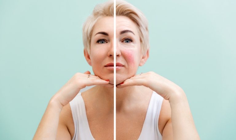 Glatte Haut ohne Chemie: Entdecken Sie natürliche Anti-Aging-Tipps!