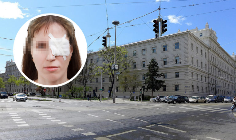 Wien: Mann verstümmelt Frau, um Versicherung zu kassieren