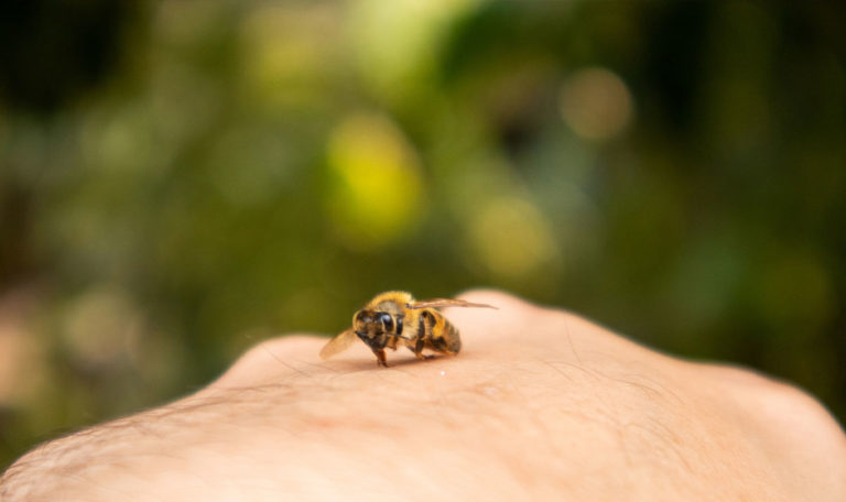 Was hilft bei Bienen- und Wespenstich?