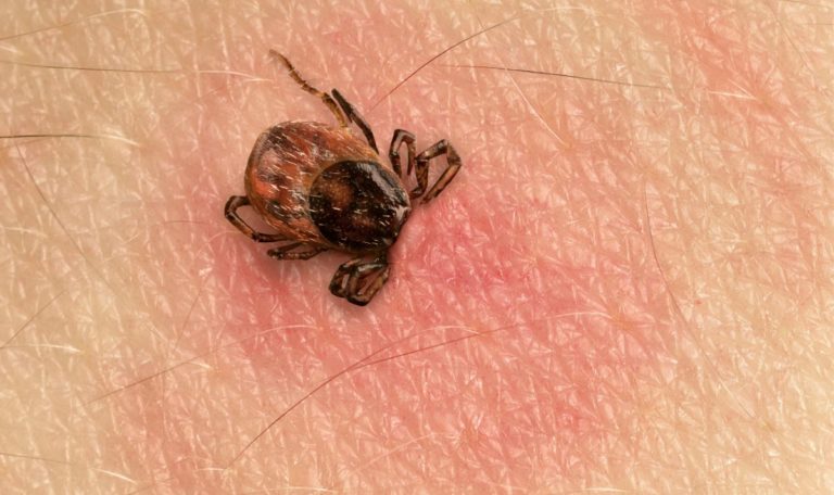 Zeckenbisse: So könnt ihr euch schützen!