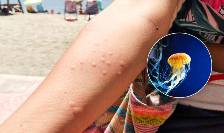 Quallen-Invasion in Kroatien: Dieser Strand ist unter rotem Alarm!