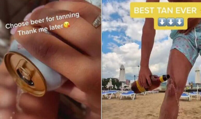 Hautkrebsgefahr wegen TikTok-Trend: Bier als Bräunungsmethode