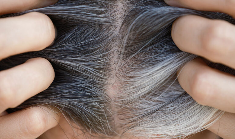 Graue Haare? Dieser Nährstoffmangel ist der Grund