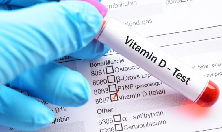 Vitamin-D-Mangel im Winter: Kostenlose Tests und Beratung in Apotheken