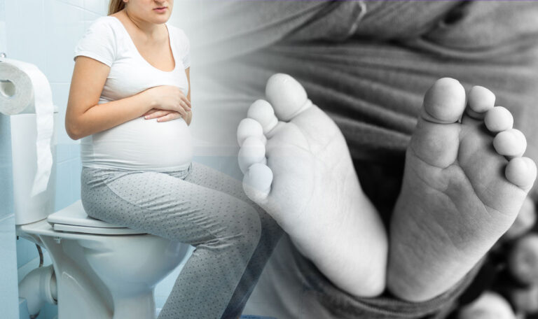 Serbin gebärt Zwillinge auf WC – Baby tot