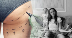 MUTTER_KINDER_PO_OPERATION
