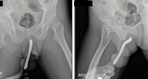 (FOTO: International Journal of Surgery Case Reports)