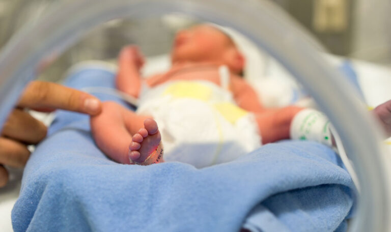 Baby kommt mit einem Ohr auf der Wange zur Welt