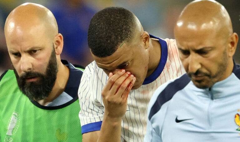 Das ist die Maske, mit der Mbappe spielen wird! (VIDEO)