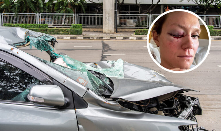 Am Heimweg von Feier: Medaillengewinnerin stirbt fast bei Unfall