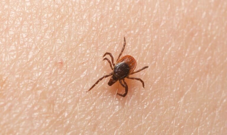 FSME-Infektion: Bereits 25 Personen im Krankenhaus behandelt