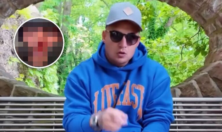 Blutige Nase und Schnittwunden: Pietro Lombardi brutal verprügelt