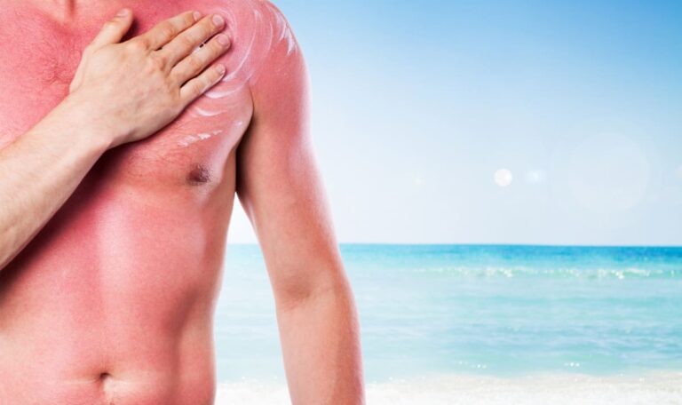 Strahlen-Ranking enthüllt: In diesen Urlaubsländern ist die Sonne am gefährlichsten