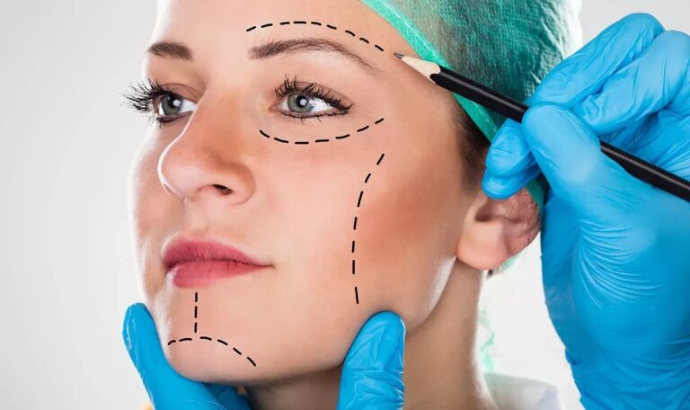 Beauty-Falle Instagram: Ärzte schlagen Alarm bei Schönheits-OPs