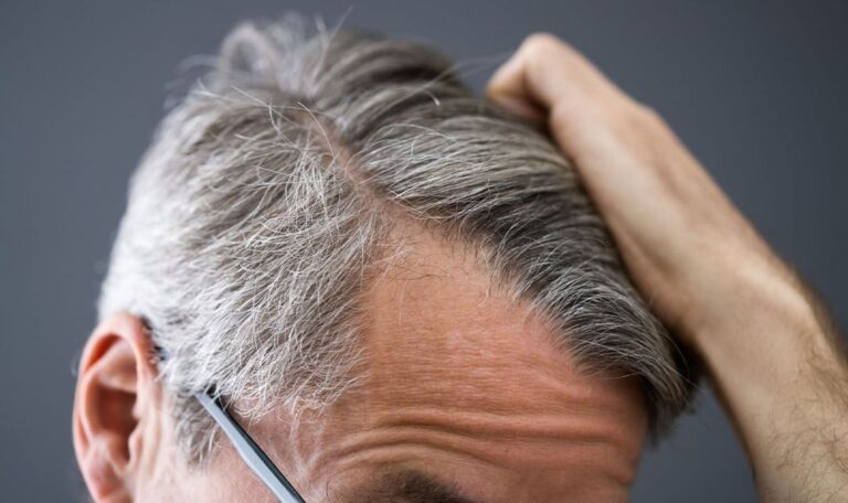 Wachsen mehr graue Haare nach, wenn man sie ausreißt?
