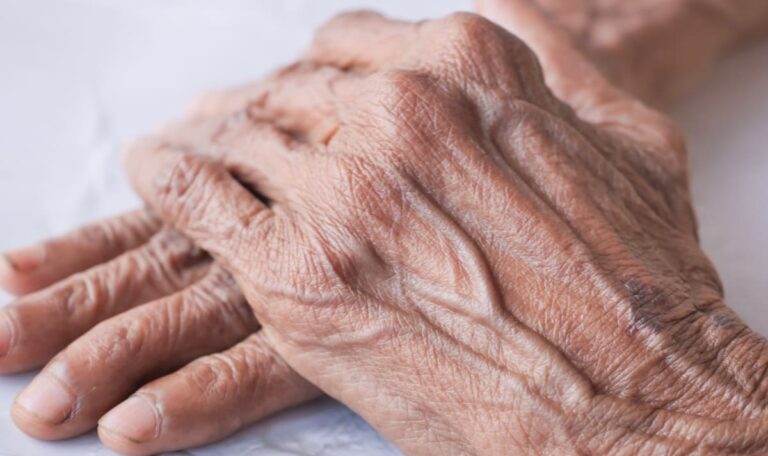 Sieben Tage in Exkrementen: Seniorin stirbt – Familie schaut zu