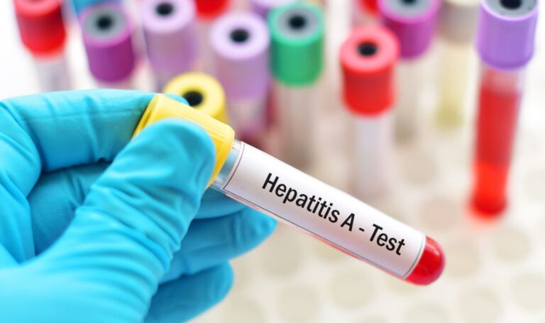 Hepatitis-Alarm aus Tschechien: Experten warnen vor Ausbreitung