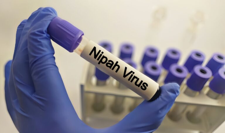 Virus mit 75% Todesrate breitet sich aus – Europa kann aufatmen