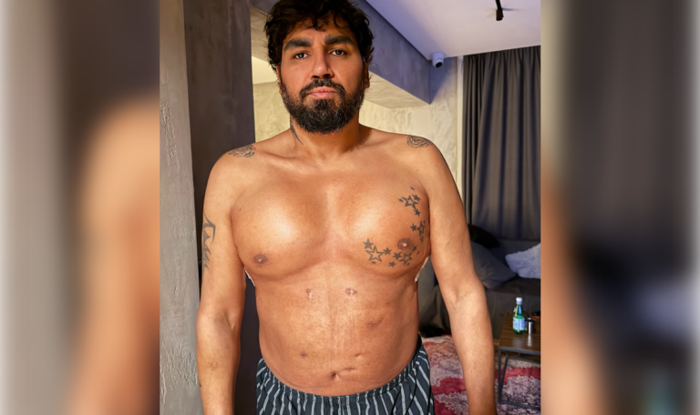 Neue Bilder sorgen für Aufsehen: Sänger Azis mit Silikon-Brust!