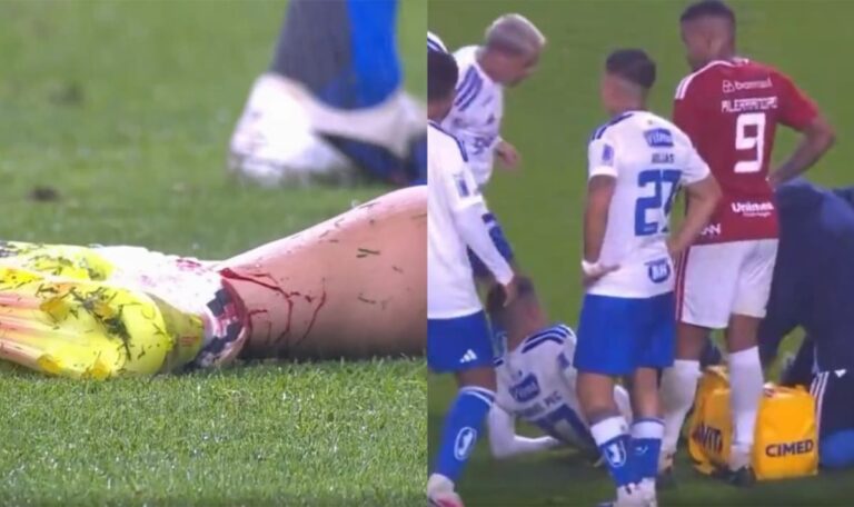 Schienbeinbruch: Einzigartige Strafe nach Brutalo-Foul (VIDEO)