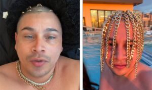Extremer Look: Rapper lässt sich Goldketten am Kopf befestigen