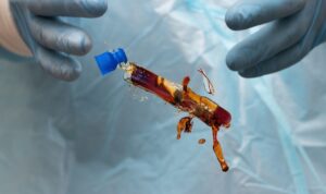 Lungenpest-Verdacht: Forscherin stirbt, 200 Menschen unter Quarantäne